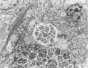 normal seromucinous salivary gland normal seromucinous salivary gland